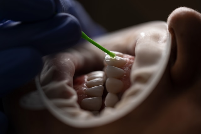The Benefits of Professional Teeth Cleaning for a Brighter Smile